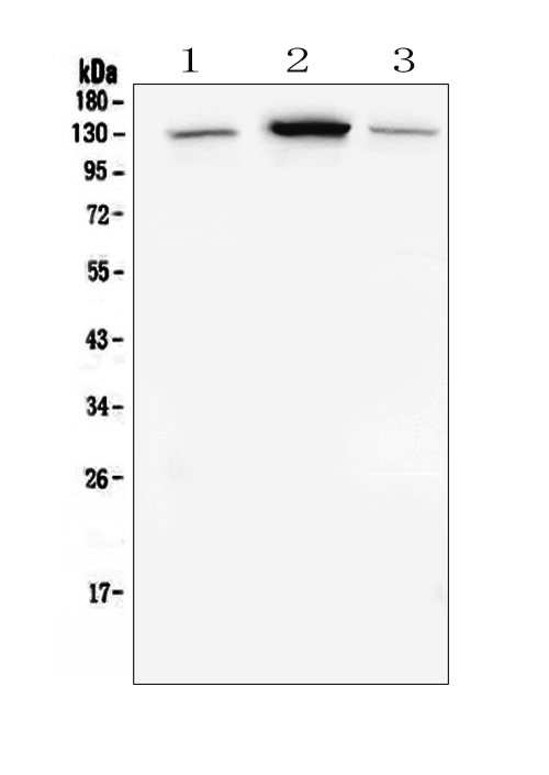 WB - Anti-E Cadherin 1 CDH1 Antibody Picoband™ (monoclonal, 9G2) ABO14856